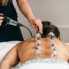 Cupping therapy on women's back